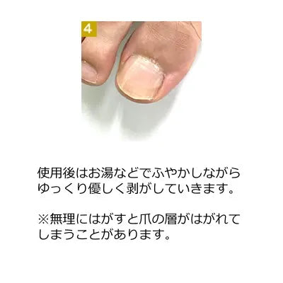 アスリートネイル スポーツネイルテープ（足爪用）athlete nail sports nail tape foot